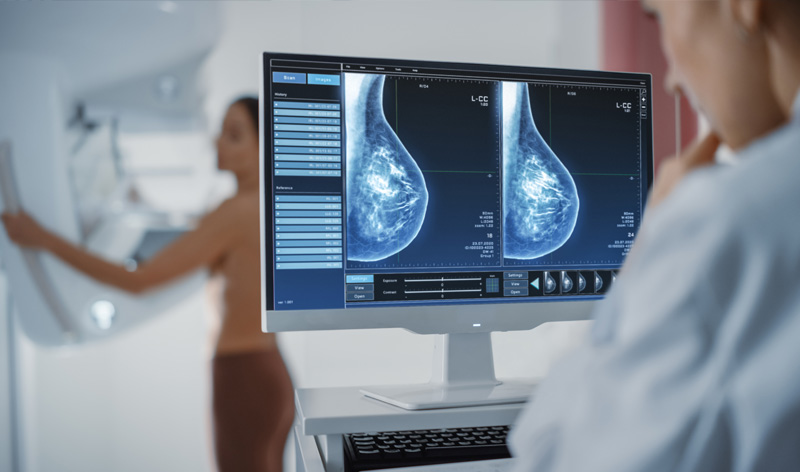 Breast Imaging Mammography